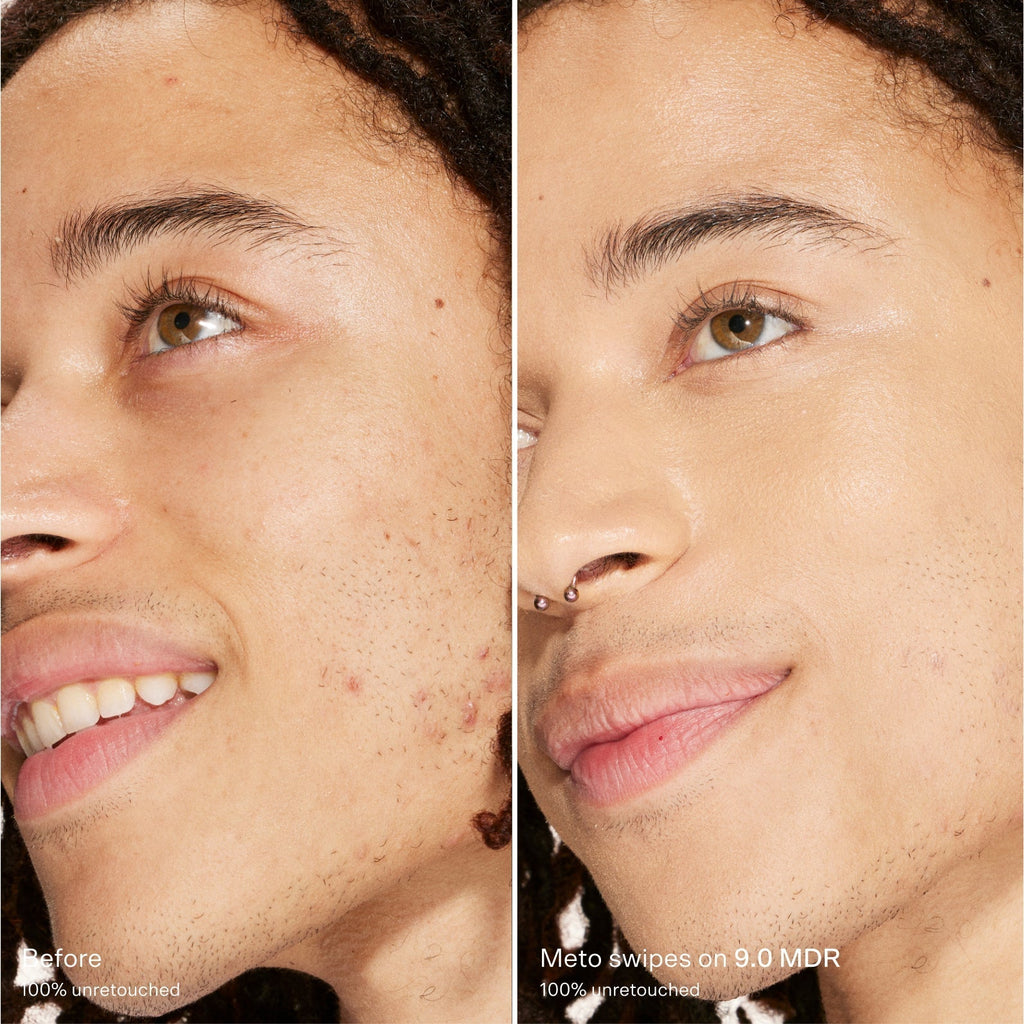 Swipe Serum Concealer® D5