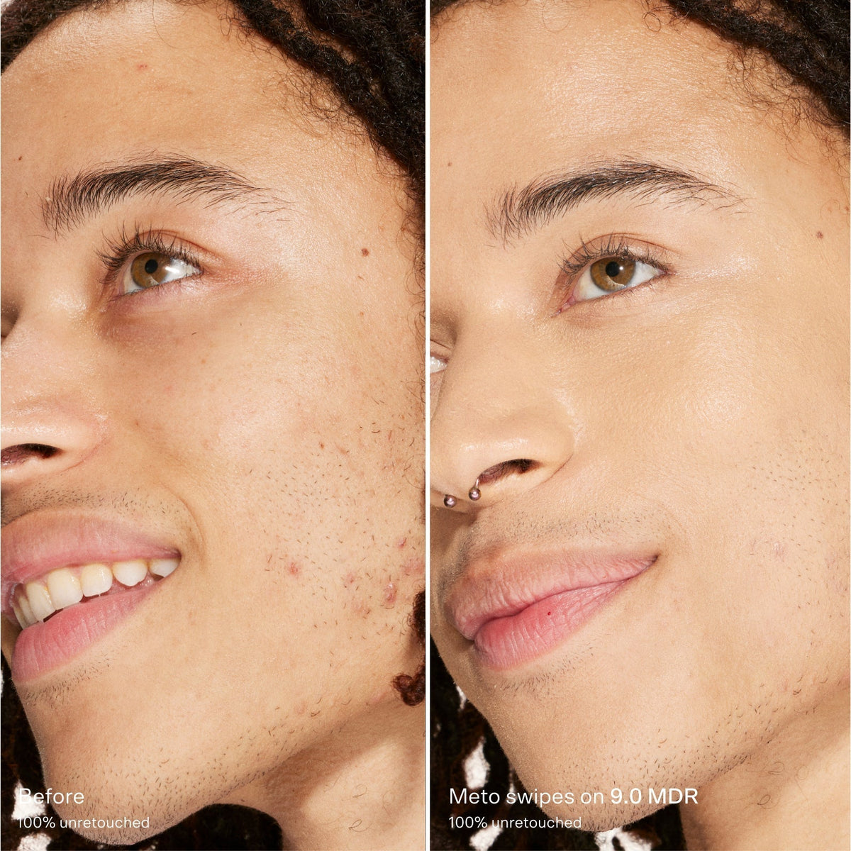 Swipe Serum Concealer® D5