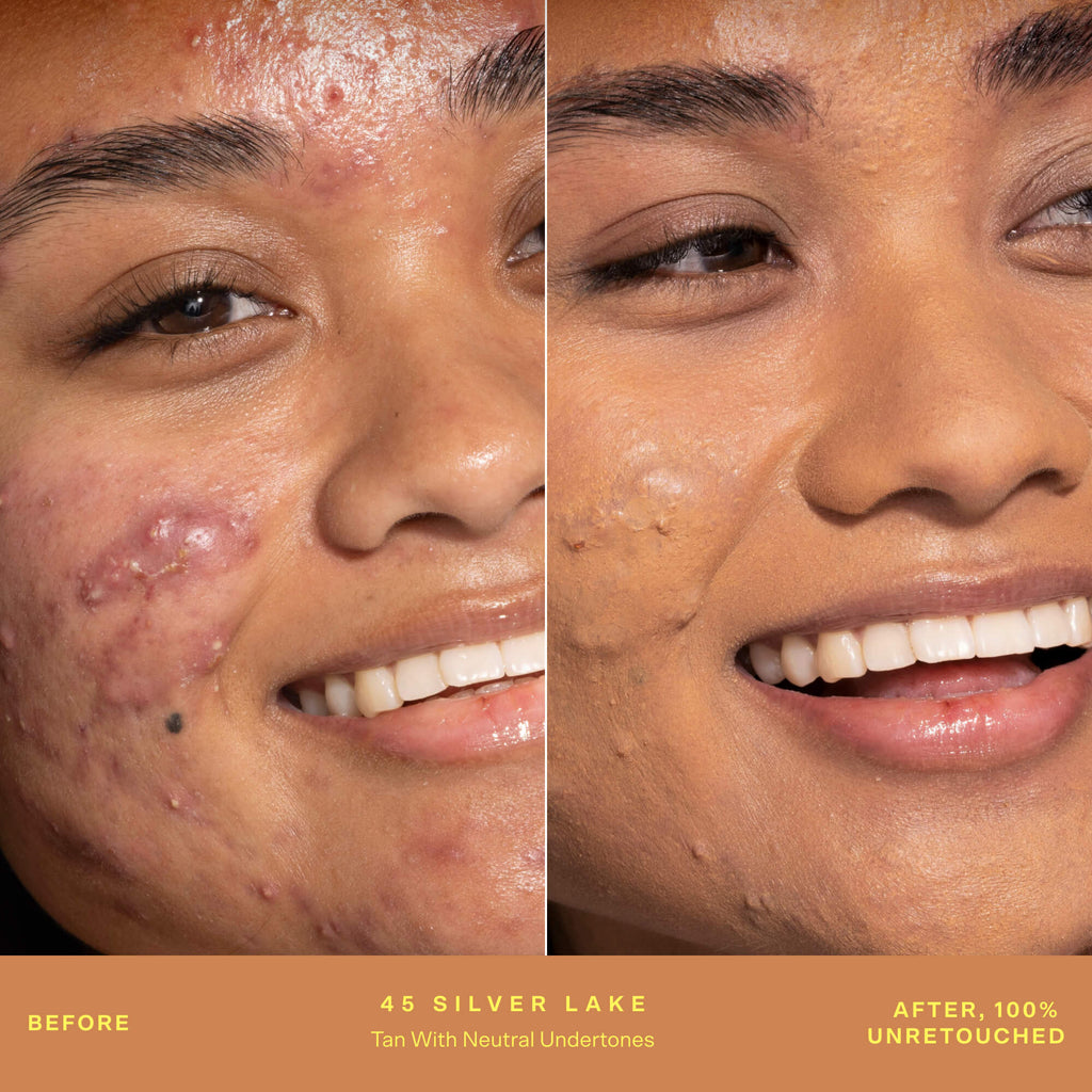SunnyDays™ Tinted SPF 30 O8