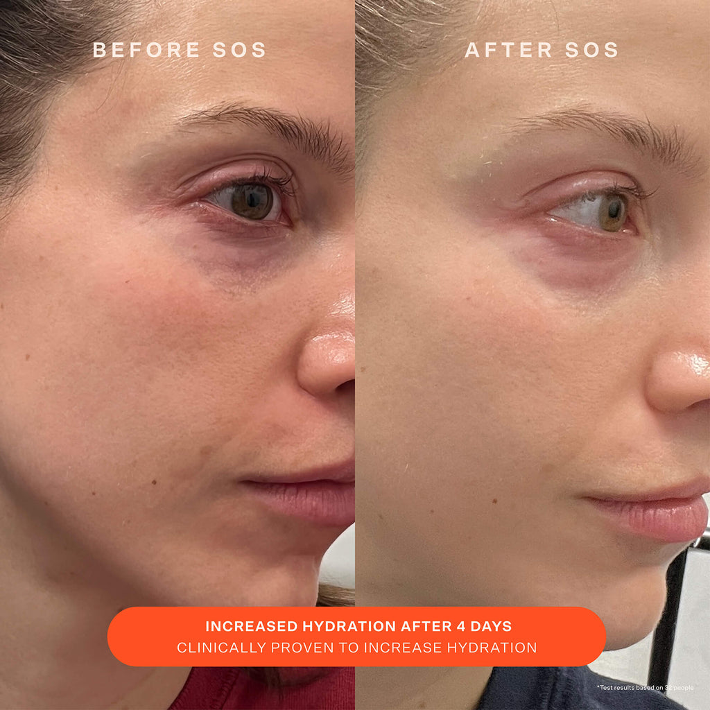 SOS Recovery Cream O5