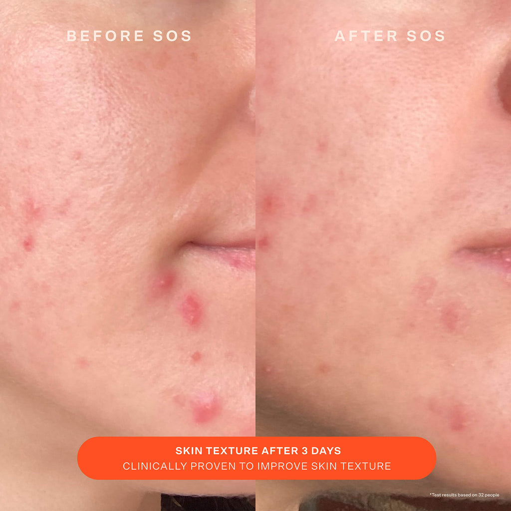 SOS Recovery Cream O5