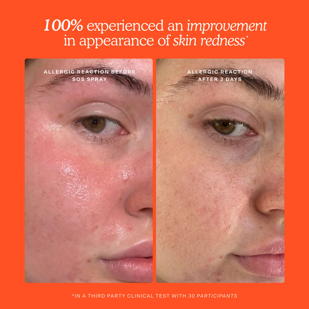 SOS Skincare Minis Kit S2