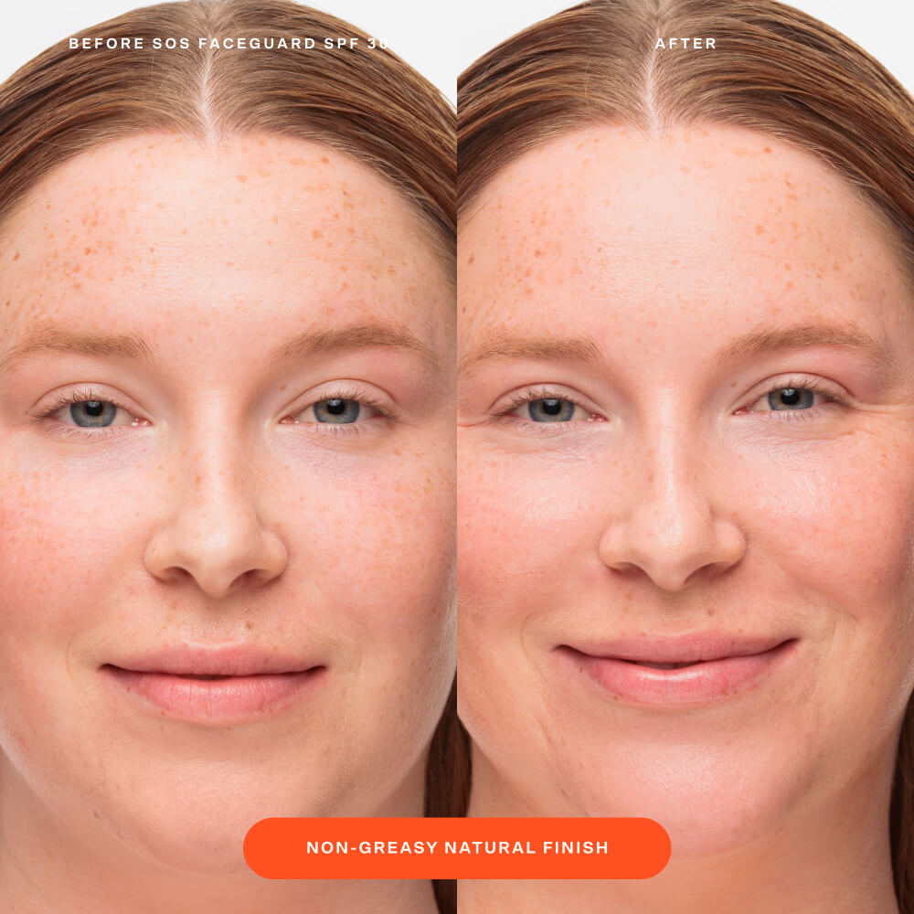 SOS FaceGuard™ SPF 30 Sunscreen PA+++ F9