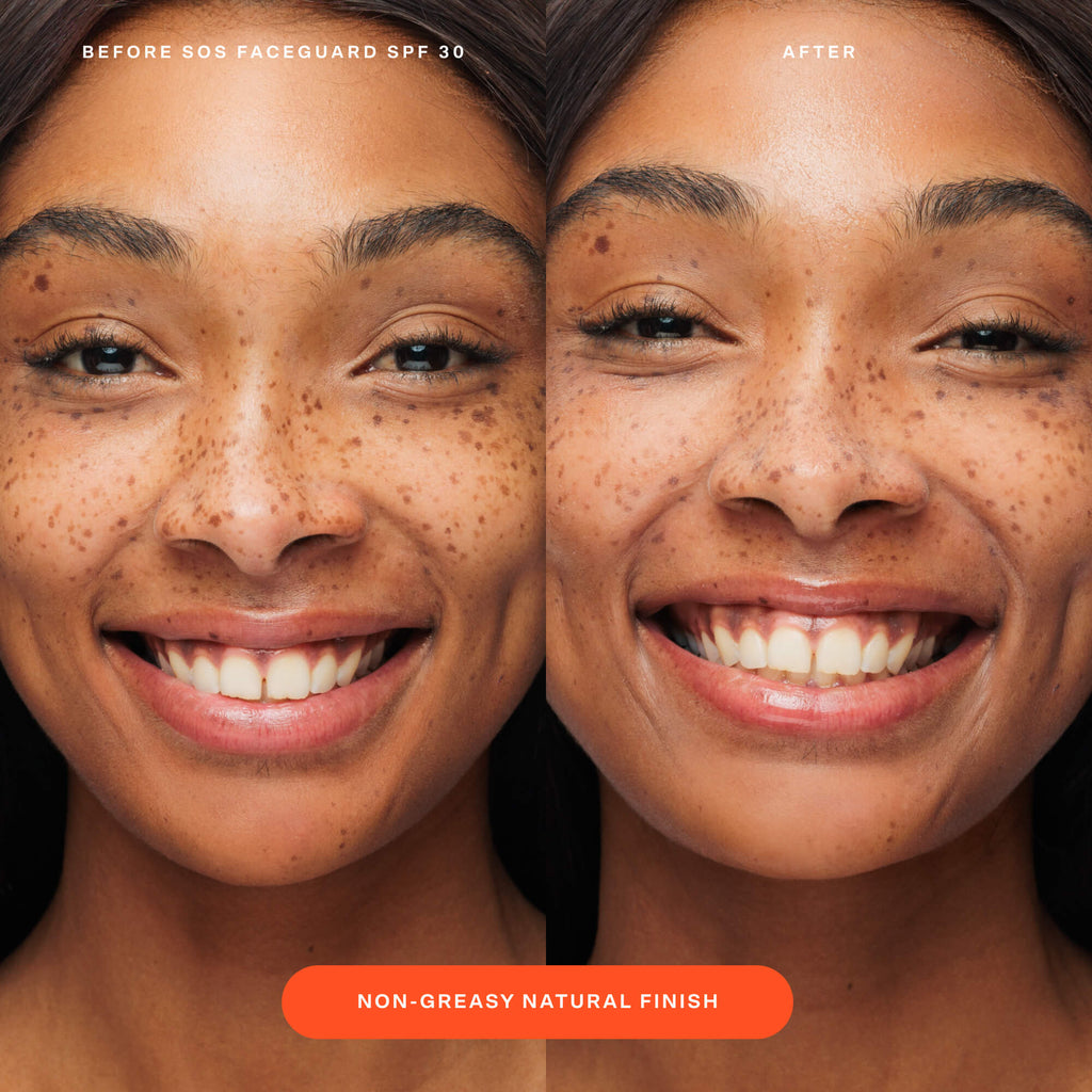 SOS FaceGuard™ SPF 30 Sunscreen PA+++ S5