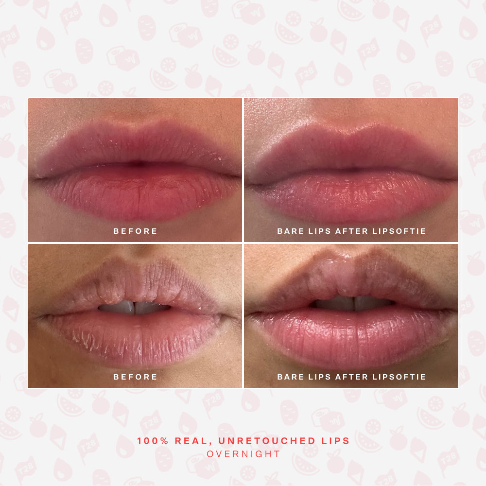 SOS LipSoftie® Lip Treatment N0