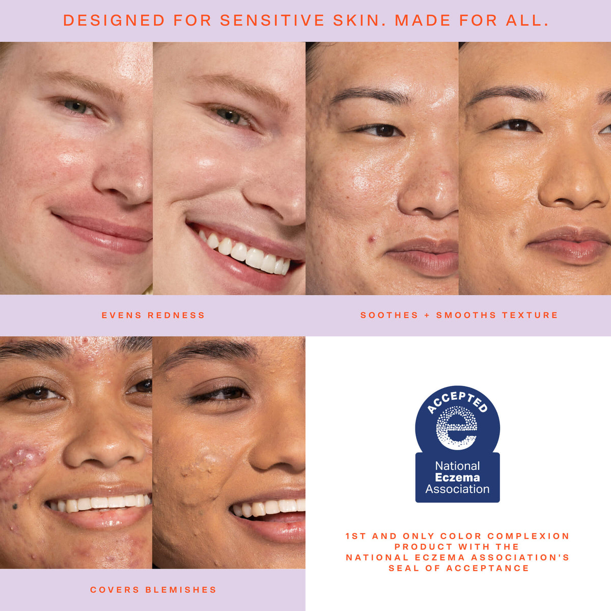 SunnyDays™ Tinted SPF 30 O8